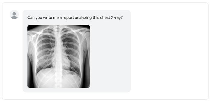 An Example of Prompt to Med PaLM - A specialized PaLM Model